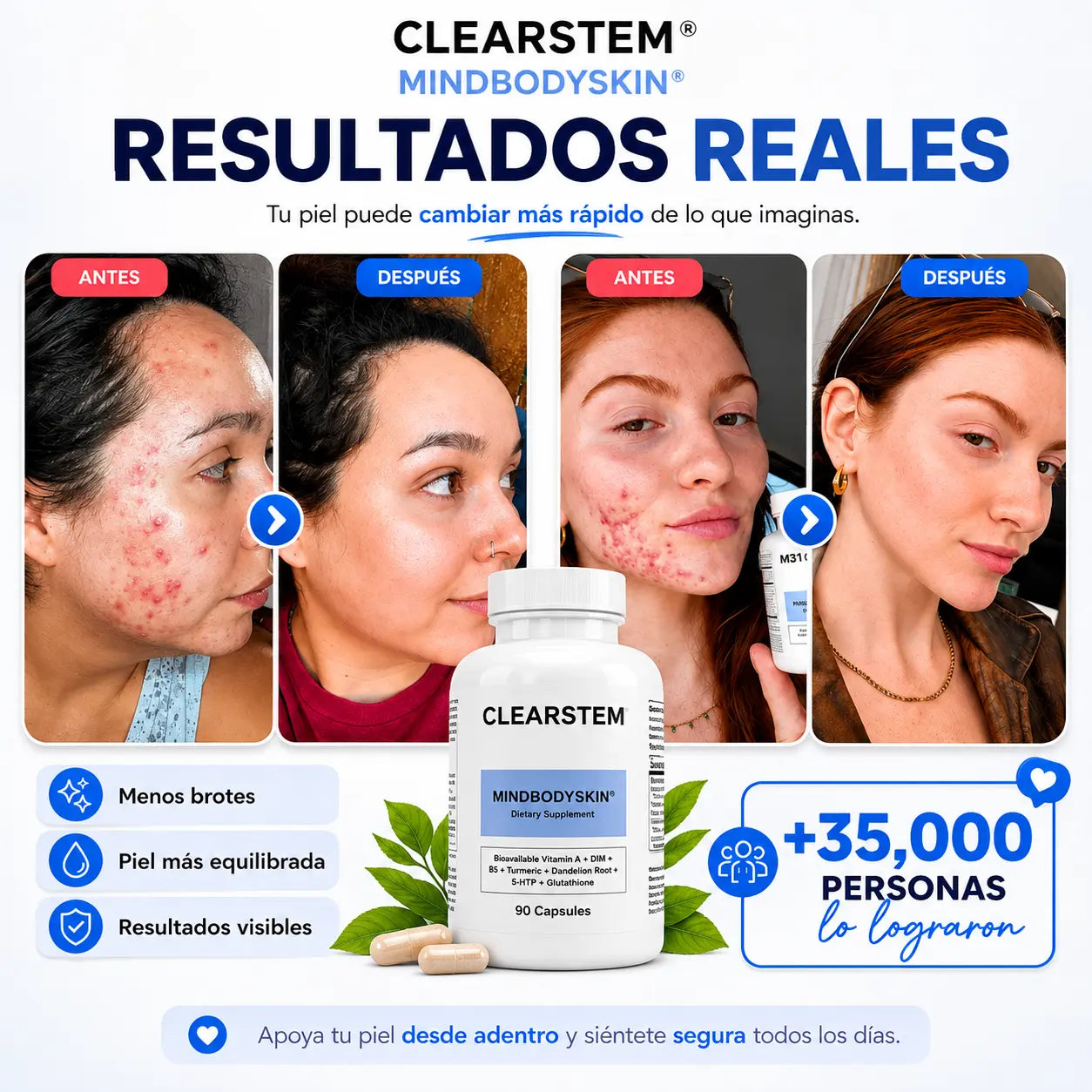 Clearstem™ - Arranca el Acné de Raíz